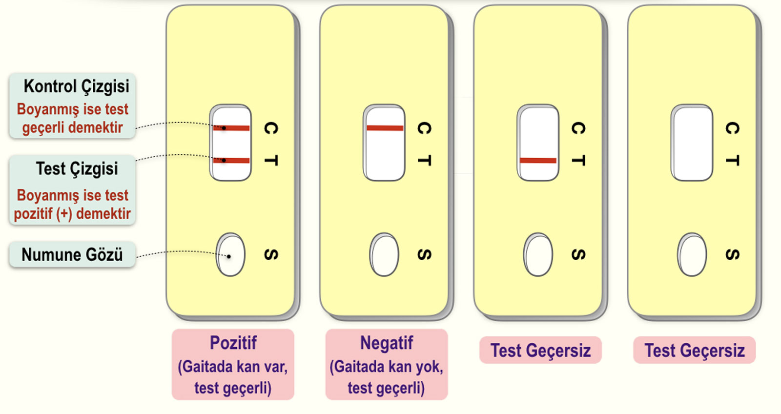 Gaitada Gizli Kan Testi Sonuçları Nasıl Yorumlanır?