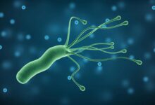 helicobacter pylori 0