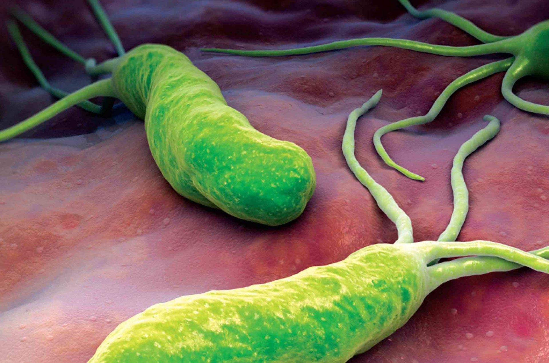 Helikobakter pilori enfeksiyonu mide kanserine neden olur mu?